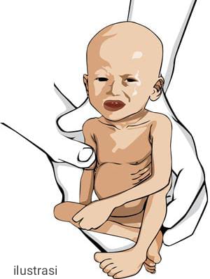 Angka Stunting 9.600 Kasus, Pemkab Tangerang Klaim Lebih Rendah dari Tahun 2021