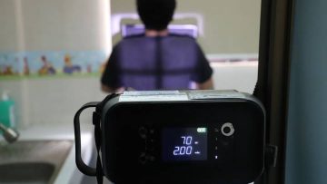 Active Case Finding Perkuat Eliminasi TBC di Banten