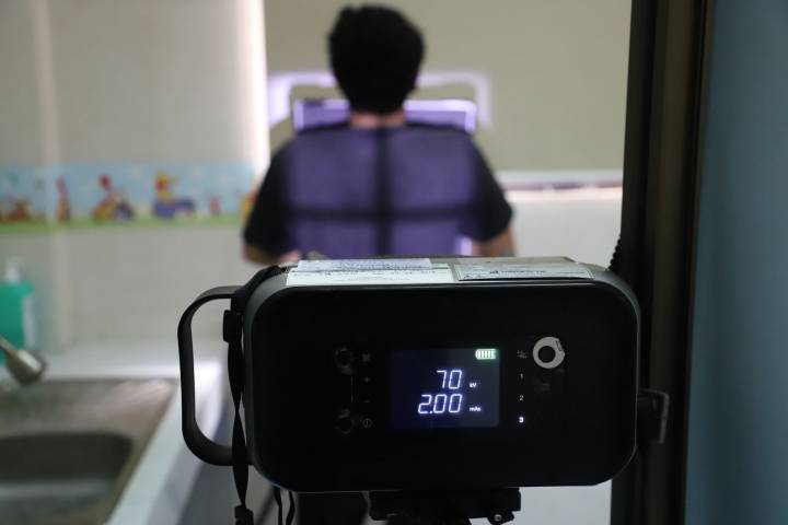 Active Case Finding Perkuat Eliminasi TBC di Banten